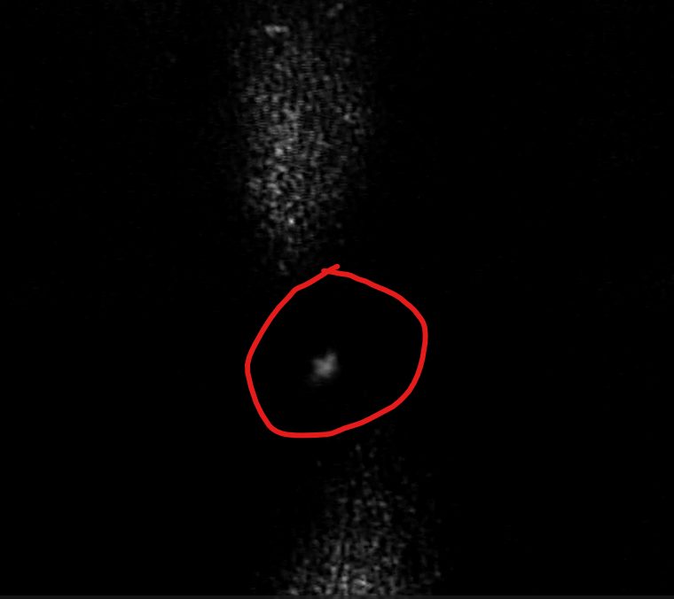 Absorption image of an atomic cloud